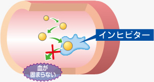 インヒビターがある場合