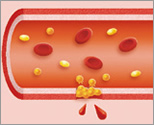 血友病患者さんの血液の固まり方：図２