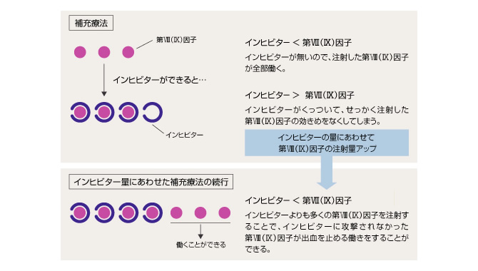 血友病インヒビター - 投与する量を増やして治療する理由