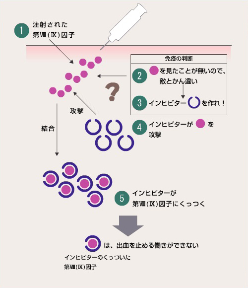 インヒビターが作られるメカニズム