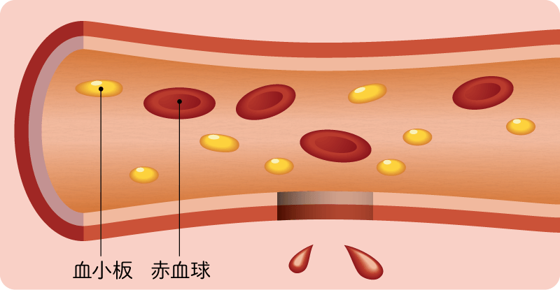 出血から止血まで【図1】(血友病基礎講座)