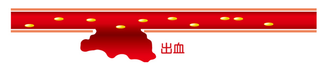 出血から止血まで【図1】(血友病基礎講座)