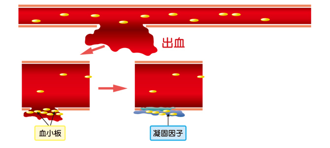出血から止血まで【図3】(血友病基礎講座)