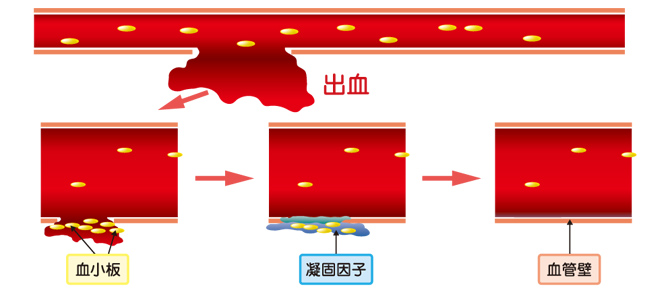 出血から止血まで【図4】(血友病基礎講座)