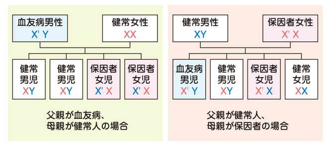 血友病の遺伝形式（X連鎖劣性遺伝）