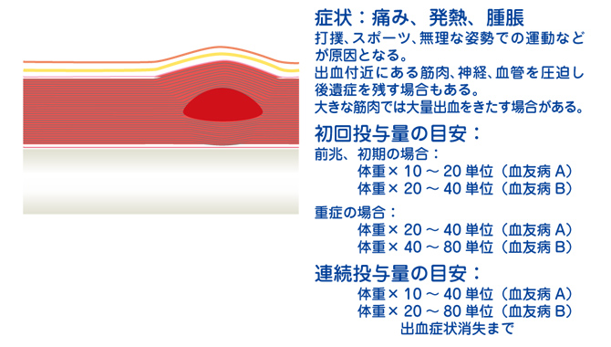 筋肉内出血 腸腰筋出血 出血時補充療法 出血の種類と初期投与量 ヘモフィリアステーション