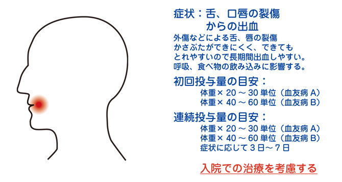 口腔内出血 血友病の症状 ヘモフィリアステーション