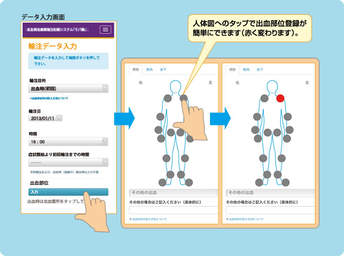 タップで出血部位登録がさらに簡単！