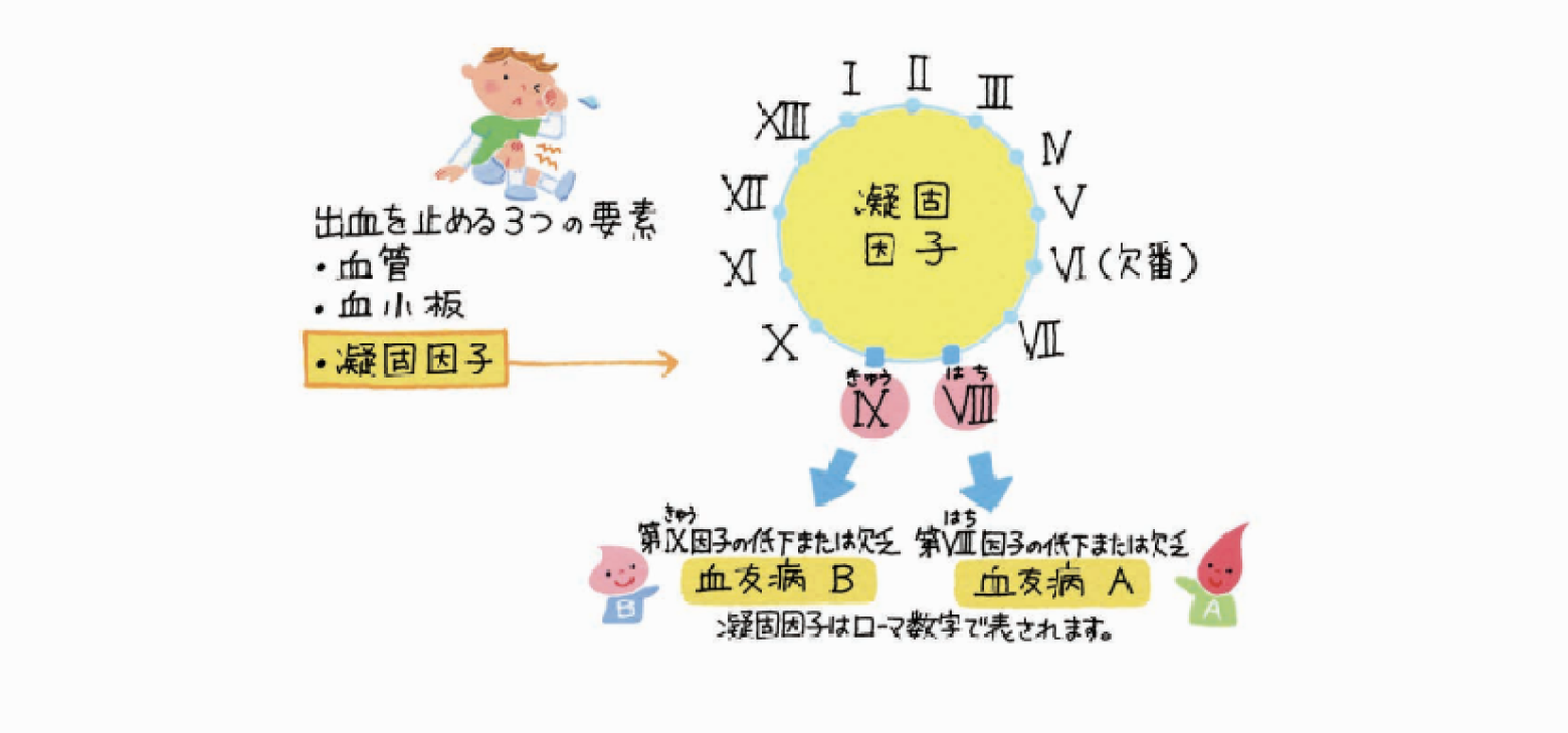 血友病のタイプ「血友病A」と「血友病B」について